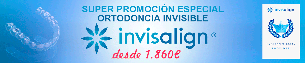 Super Promoción Especial, ortodoncia invisible INVISALIGN desde 1.860€
